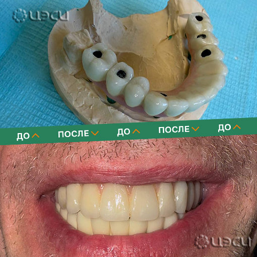 Смотреть До-после