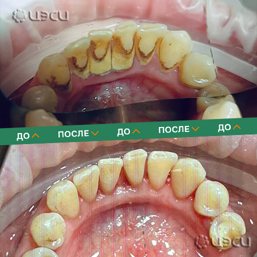 Смотреть до/после